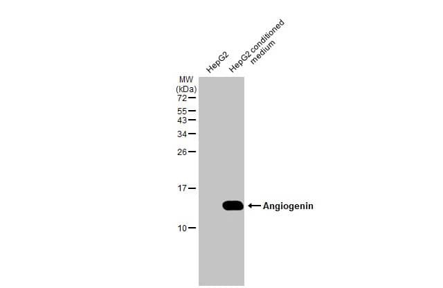 Western Blot: Angiogenin Antibody (HL2215) - Azide and BSA Free [NBP3-25361] - HepG2 whole cell extract and conditioned medium (30 ug) were separated by 15% SDS-PAGE, and the membrane was blotted with Angiogenin antibody [HL2215] (NBP3-25361) diluted at 1:1000. The HRP-conjugated anti-rabbit IgG antibody was used to detect the primary antibody.