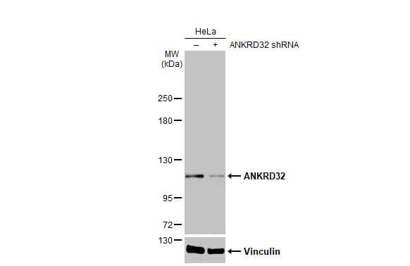 Knockdown Validated: ANKRD32 Antibody (HL2311) - Azide and BSA Free [NBP3-25362] - Non-transfected (-) and transfected (+) HeLa whole cell extracts (30 ug) were separated by 5% SDS-PAGE, and the membrane was blotted with ANKRD32 antibody [HL2311] (NBP3-25362) diluted at 1:1000. The HRP-conjugated anti-rabbit IgG antibody was used to detect the primary antibody, and the signal was developed with Trident ECL plus-Enhanced.