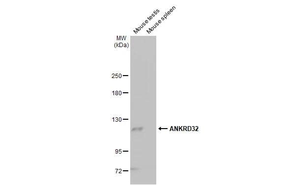 <b>Genetic Strategies Validation. </b>Various tissue extracts (50 ug) were separated by 5% SDS-PAGE, and the membrane was blotted with ANKRD32 antibody [HL2311] (NBP3-25362) diluted at 1:1000. The HRP-conjugated anti-rabbit IgG antibody  was used to detect the primary antibody. 