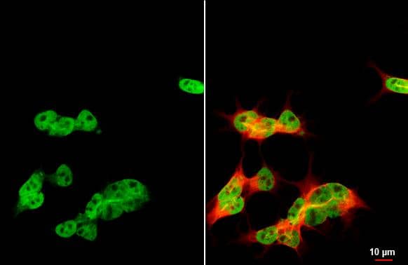 ARID1A antibody [HL2304] detects ARID1A protein by immunofluorescent analysis.Sample: SH-SY-5Y cells were fixed in 4% paraformaldehyde at RT for 15 min.Green: ARID1A stained by ARID1A antibody [HL2304] (NBP3-25363) diluted at 1:500.Red: alpha Tubulin, a cytoskeleton marker, stained by alpha Tubulin antibody [GT114]  diluted at 1:1000. 