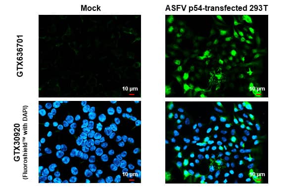 Immunocytochemistry/Immunofluorescence: African Swine Fever Virus p54 Antibody (HL1287) - Azide and BSA Free [NBP3-25369] - ASFV p54 antibody [HL1287] detects ASFV p54 protein by immunofluorescent analysis. Sample: Mock and transfected 293T cells were fixed in 4% paraformaldehyde at RT for 15 min. Green: ASFV p54 stained by ASFV p54 antibody [HL1287] (NBP3-25369) diluted at 1:500. Blue: Fluoroshield with DAPI .