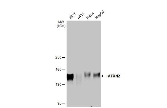 Various whole cell extracts (30 ug) were separated by 5% SDS-PAGE, and the membrane was blotted with ATXN2 antibody [HL1902] (NBP3-25373) diluted at 1:1000. The HRP-conjugated anti-rabbit IgG antibody  was used to detect the primary antibody. 