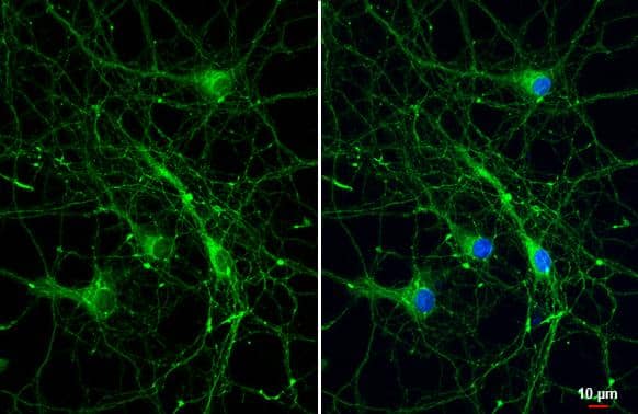 Bassoon antibody [HL1732] detects Bassoon protein at synapse by immunofluorescent analysis.Sample: DIV9 rat E18 primary hippocampal neuron cells were fixed in 4% paraformaldehyde at RT for 15 min.Green: Bassoon stained by Bassoon antibody [HL1732] (NBP3-25376) diluted at 1:250.Blue: Fluoroshield with DAPI . 