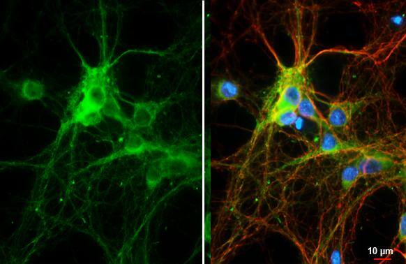Bassoon antibody [HL1732] detects Bassoon protein by immunofluorescent analysis.Sample: DIV9 rat E18 primary hippocampal neurons cells were fixed in 4% paraformaldehyde at RT for 15 min.Green: Bassoon stained by Bassoon antibody [HL1732] (NBP3-25376) diluted at 1:250.Red: Tau, a axon  marker, stained by Tau antibody [GT287]  diluted at 1:500.Blue: Fluoroshield with DAPI . 