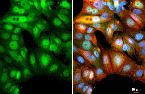 Immunocytochemistry/Immunofluorescence: BATF Antibody (HL1870) - Azide and BSA Free [NBP3-25377] - BATF antibody [HL1870] detects BATF protein by immunofluorescent analysis. Sample: MCF-7 cells were fixed in 4% paraformaldehyde at RT for 15 min. Green: BATF stained by BATF antibody [HL1870] (NBP3-25377) diluted at 1:500. Red: alpha Tubulin, a cytoskeleton marker, stained by alpha Tubulin antibody [GT114] (NBP2-43837) diluted at 1:1000. Blue: Fluoroshield with DAPI . Scale bar= 10um.