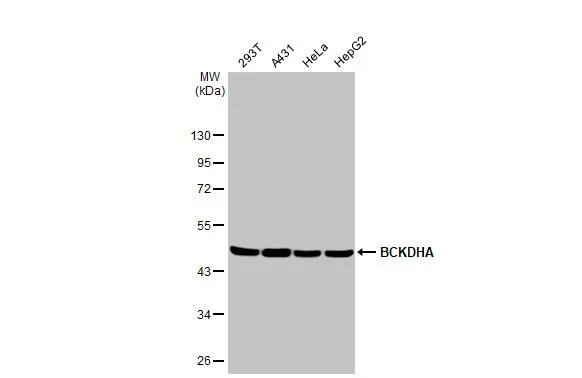 Western Blot: BCKDHA Antibody (HL2405) - Azide and BSA Free [NBP3-25380] - Various whole cell extracts (30 ug) were separated by 10% SDS-PAGE, and the membrane was blotted with BCKDHA antibody [HL2405] (NBP3-25380) diluted at 1:1000. The HRP-conjugated anti-rabbit IgG antibody was used to detect the primary antibody.