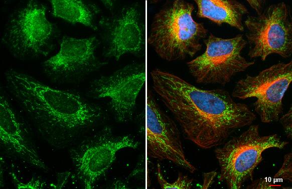 Immunocytochemistry/Immunofluorescence: BCKDHA Antibody (HL2405) - Azide and BSA Free [NBP3-25380] - BCKDHA antibody [HL2405] detects BCKDHA protein at mitochondria by immunofluorescent analysis. Sample: HeLa cells were fixed in 4% paraformaldehyde at RT for 15 min. Green: BCKDHA stained by BCKDHA antibody [HL2405] (NBP3-25380) diluted at 1:500. Red: alpha Tubulin, a cytoskeleton marker, stained by alpha Tubulin antibody [GT114] (NBP2-43837) diluted at 1:1000. Blue: Fluoroshield with DAPI .