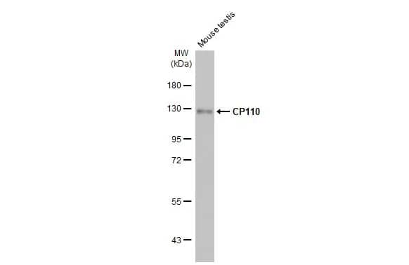 Western Blot: CCP110 Antibody (HL2312) - Azide and BSA Free [NBP3-25381] - Mouse tissue extract (50 ug) was separated by 7.5% SDS-PAGE, and the membrane was blotted with CP110 antibody [HL2312] (NBP3-25381) diluted at 1:1000. The HRP-conjugated anti-rabbit IgG antibody was used to detect the primary antibody.