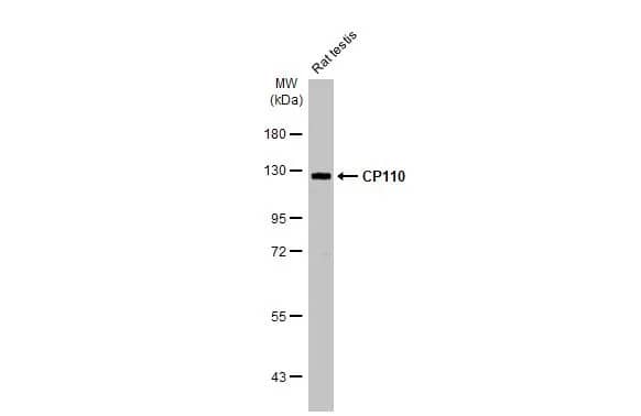 Western Blot: CCP110 Antibody (HL2312) - Azide and BSA Free [NBP3-25381] - Rat tissue extract (50 ug) was separated by 7.5% SDS-PAGE, and the membrane was blotted with CP110 antibody [HL2312] (NBP3-25381) diluted at 1:1000. The HRP-conjugated anti-rabbit IgG antibody was used to detect the primary antibody.