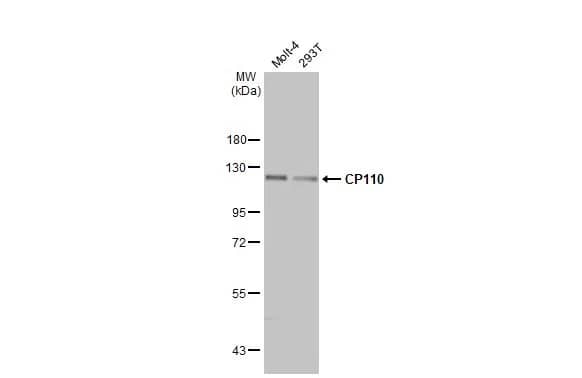 Western Blot: CCP110 Antibody (HL2312) - Azide and BSA Free [NBP3-25381] - Various whole cell extracts (30 ug) were separated by 7.5% SDS-PAGE, and the membrane was blotted with CP110 antibody [HL2312] (NBP3-25381) diluted at 1:2000. The HRP-conjugated anti-rabbit IgG antibody was used to detect the primary antibody.