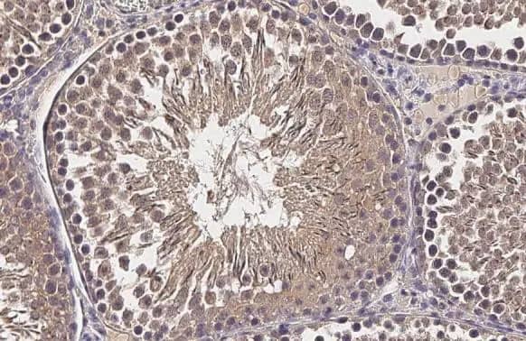 Immunohistochemistry-Paraffin: CCP110 Antibody (HL2312) - Azide and BSA Free [NBP3-25381] - CP110 antibody [HL2312] detects CP110 protein at cytoplasm by immunohistochemical analysis. Sample: Paraffin-embedded rat testis. CP110 stained by CP110 antibody [HL2312] (NBP3-25381) diluted at 1:1000. Antigen Retrieval: Citrate buffer, pH 6.0, 15 min