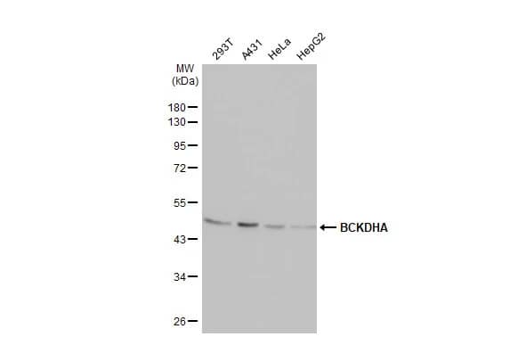 Western Blot: BCKDHA Antibody (HL2434) - Azide and BSA Free [NBP3-25382] - Various whole cell extracts (30 ug) were separated by 10% SDS-PAGE, and the membrane was blotted with BCKDHA antibody [HL2434] (NBP3-25382) diluted at 1:1000. The HRP-conjugated anti-rabbit IgG antibody was used to detect the primary antibody.