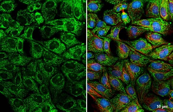 Bcl-XL antibody [HL2038] detects Bcl-XL protein by immunofluorescent analysis.Sample: MDCK cells were fixed in ice-cold MeOH for 5 min.Green: Bcl-XL stained by Bcl-XL antibody [HL2038] (NBP3-25383) diluted at 1:500.Red: alpha Tubulin, a cytoskeleton marker, stained by alpha Tubulin antibody [GT114]  diluted at 1:1000.Blue: Fluoroshield with DAPI . 