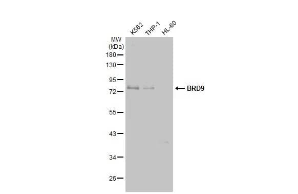 Western Blot: BRD9 Antibody (HL1282) - Azide and BSA Free [NBP3-25385] - Various whole cell extracts (30 ug) were separated by 10% SDS-PAGE, and the membrane was blotted with BRD9 antibody [HL1282] (NBP3-25385) diluted at 1:1000. The HRP-conjugated anti-rabbit IgG antibody was used to detect the primary antibody.
