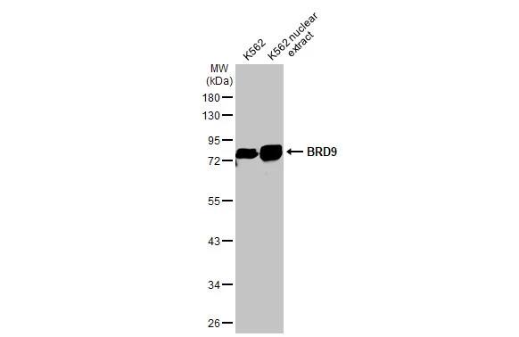 Western Blot: BRD9 Antibody (HL1282) - Azide and BSA Free [NBP3-25385] - K562 whole cell and nuclear extracts (30 ug) were separated by 10% SDS-PAGE, and the membrane was blotted with BRD9 antibody [HL1282] (NBP3-25385) diluted at 1:1000. The HRP-conjugated anti-rabbit IgG antibody was used to detect the primary antibody.
