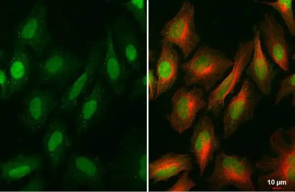 Immunocytochemistry/Immunofluorescence: BRD9 Antibody (HL1282) - Azide and BSA Free [NBP3-25385] - BRD9 antibody [HL1282] detects BRD9 protein at nucleus by immunofluorescent analysis. Sample: HeLa cells were fixed in 4% paraformaldehyde at RT for 15 min. Green: BRD9 stained by BRD9 antibody [HL1282] (NBP3-25385) diluted at 1:500. Red: alpha Tubulin, a cytoskeleton marker, stained by alpha Tubulin antibody [GT114] diluted at 1:1000.