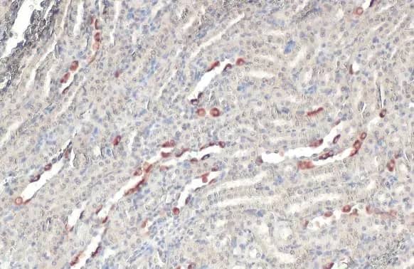Immunohistochemistry-Paraffin: BRD9 Antibody (HL1282) - Azide and BSA Free [NBP3-25385] - BRD9 antibody [HL1282] detects BRD9 protein at cell membrane and cytoplasm by immunohistochemical analysis. Sample: Paraffin-embedded mouse kidney. BRD9 stained by BRD9 antibody [HL1282] (NBP3-25385) diluted at 1:100. Antigen Retrieval: Citrate buffer, pH 6.0, 15 min