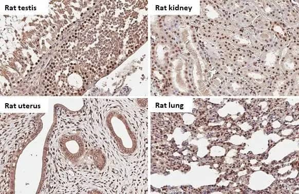 Immunohistochemistry-Paraffin: BRD9 Antibody (HL1282) - Azide and BSA Free [NBP3-25385] - BRD9 antibody [HL1282] detects BRD9 protein by immunohistochemical analysis. Sample: Paraffin-embedded rat tissues. BRD9 stained by BRD9 antibody [HL1282] (NBP3-25385) diluted at 1:100. Antigen Retrieval: Citrate buffer, pH 6.0, 15 min