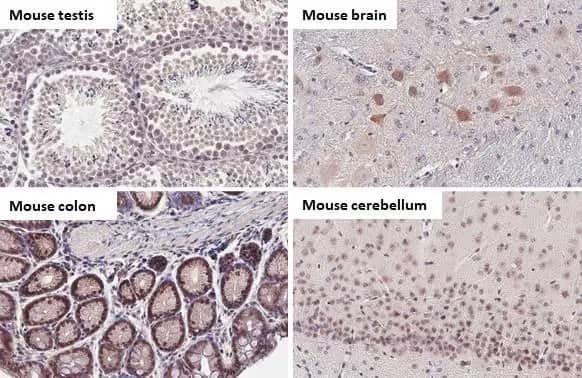 Immunohistochemistry-Paraffin: BRD9 Antibody (HL1282) - Azide and BSA Free [NBP3-25385] - BRD9 antibody [HL1282] detects BRD9 protein by immunohistochemical analysis. Sample: Paraffin-embedded mouse tissues. BRD9 stained by BRD9 antibody [HL1282] (NBP3-25385) diluted at 1:100. Antigen Retrieval: Citrate buffer, pH 6.0, 15 min