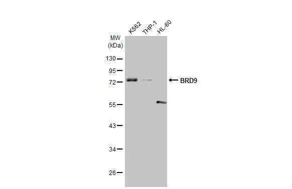 Various whole cell extracts (30 ug) were separated by 10% SDS-PAGE, and the membrane was blotted with BRD9 antibody [HL1282] (NBP3-25385) diluted at 1:1000. The HRP-conjugated anti-rabbit IgG antibody  was used to detect the primary antibody. 