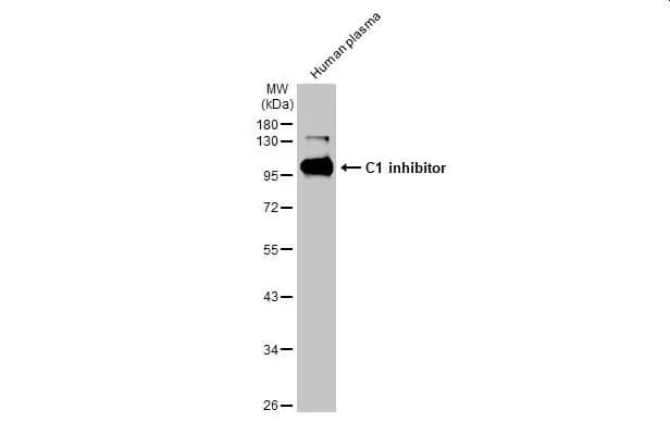 Western Blot: Serpin G1/C1 Inhibitor Antibody (HL1196) - Azide and BSA Free [NBP3-25387] - Human plasma (30 ug) was separated by 10% SDS-PAGE, and the membrane was blotted with C1 inhibitor antibody [HL1196] (NBP3-25387) diluted at 1:10000. The HRP-conjugated anti-rabbit IgG antibody was used to detect the primary antibody.