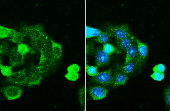 Immunocytochemistry/Immunofluorescence: Serpin G1/C1 Inhibitor Antibody (HL1196) - Azide and BSA Free [NBP3-25387] - C1 inhibitor antibody [HL1196] detects C1 inhibitor protein by immunofluorescent analysis. Sample: HepG2 cells were fixed in ice-cold MeOH for 10 min. Green: C1 inhibitor stained by C1 inhibitor antibody [HL1196] (NBP3-25387) diluted at 1:500. Blue: Fluoroshield with DAPI .