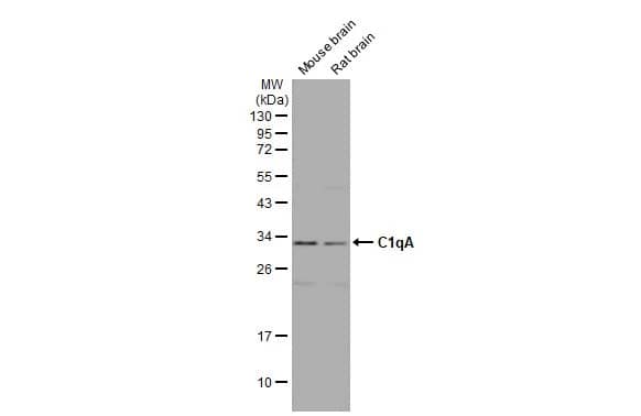 Western Blot: Complement Component C1qA Antibody (HL1695) - Azide and BSA Free [NBP3-25388] - Various tissue extracts (50 ug) were separated by 12% SDS-PAGE, and the membrane was blotted with C1qA antibody [HL1695] (NBP3-25388) diluted at 1:1000. The HRP-conjugated anti-rabbit IgG antibody was used to detect the primary antibody, and the signal was developed with Trident ECL plus-Enhanced.