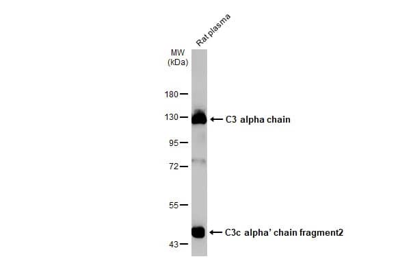 Western Blot: Complement C3 Antibody (HL1643) - Azide and BSA Free [NBP3-25389] - Rat plasma (30 ug) was separated by 7.5% SDS-PAGE, and the membrane was blotted with C3 antibody [HL1643] (NBP3-25389) diluted at 1:10000. The HRP-conjugated anti-rabbit IgG antibody was used to detect the primary antibody.