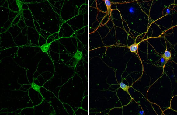 Immunocytochemistry/Immunofluorescence: Calbindin 1/2 Antibody (HL1787) - Azide and BSA Free [NBP3-25390] - Calbindin antibody [HL1787] detects Calbindin protein at cytoskeleton by immunofluorescent analysis. Sample: DIV9 rat E18 primary cortical neuron cells were fixed in 4% paraformaldehyde at RT for 15 min. Green: Calbindin stained by Calbindin antibody [HL1787] (NBP3-25390) diluted at 1:250. Red: Tau, an axon marker, stained by Tau antibody [GT287] diluted at 1:500. Blue: Fluoroshield with DAPI .