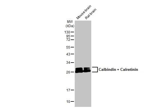 Western Blot: Calbindin 1/2 Antibody (HL1787) - Azide and BSA Free [NBP3-25390] - Various tissue extracts (50 ug) were separated by 12% SDS-PAGE, and the membrane was blotted with Calbindin + Calretinin antibody [HL1787] (NBP3-25390) diluted at 1:1000. The HRP-conjugated anti-rabbit IgG antibody was used to detect the primary antibody.