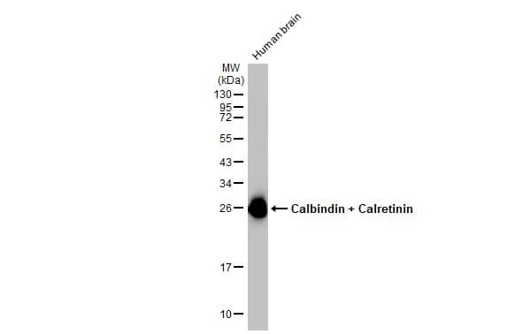 Western Blot: Calbindin 1/2 Antibody (HL1787) - Azide and BSA Free [NBP3-25390] - Human tissue extract (30 ug) was separated by 12% SDS-PAGE, and the membrane was blotted with Calbindin + Calretinin antibody [HL1787] (NBP3-25390) diluted at 1:500. The HRP-conjugated anti-rabbit IgG antibody was used to detect the primary antibody, and the signal was developed with Trident ECL plus-Enhanced.