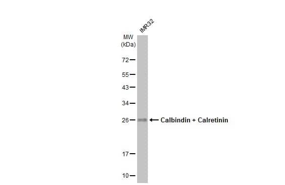 Western Blot: Calbindin 1/2 Antibody (HL1787) - Azide and BSA Free [NBP3-25390] - Whole cell extract (30 ug) was separated by 12% SDS-PAGE, and the membrane was blotted with Calbindin + Calretinin antibody [HL1787] (NBP3-25390) diluted at 1:1000. The HRP-conjugated anti-rabbit IgG antibody was used to detect the primary antibody, and the signal was developed with Trident femto Western HRP Substrate.