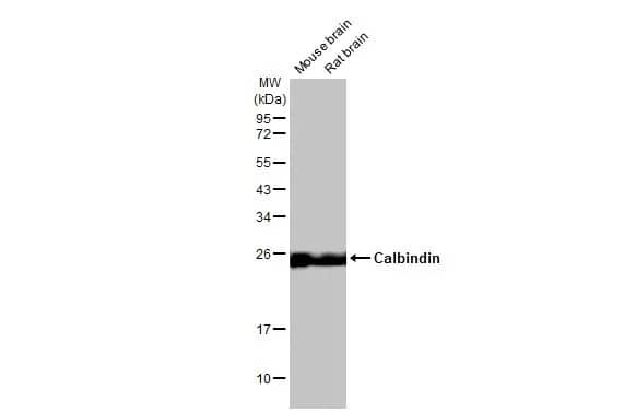 Western Blot: Calbindin D-28K Antibody (HL2378) - Azide and BSA Free [NBP3-25391] - Various tissue extracts (50 ug) were separated by 12% SDS-PAGE, and the membrane was blotted with Calbindin antibody [HL2378] (NBP3-25391) diluted at 1:1000. The HRP-conjugated anti-rabbit IgG antibody was used to detect the primary antibody.