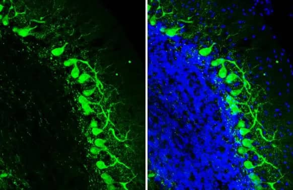 Immunohistochemistry-Frozen: Calbindin D-28K Antibody (HL2378) - Azide and BSA Free [NBP3-25391] - Calbindin antibody [HL2378] detects Calbindin protein by immunohistochemical analysis. Sample: Frozen-sectioned mouse cerebellum. Green: Calbindin stained by Calbindin antibody [HL2378] (NBP3-25391) diluted at 1:300. Blue: Fluoroshield with DAPI .