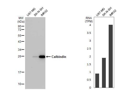 <b>Orthogonal Strategies Validation. </b>Western Blot: Calbindin D-28K Antibody (HL2379) - Azide and BSA Free [NBP3-25392] - Various whole cell extracts (30 ug) were separated by 12% SDS-PAGE, and the membrane was blotted with Calbindin antibody [HL2379] (NBP3-25392) diluted at 1:1000. The HRP-conjugated anti-rabbit IgG antibody was used to detect the primary antibody. Corresponding RNA expression data for the same cell lines are based on Human Protein Atlas program.