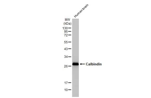 Western Blot: Calbindin D-28K Antibody (HL2379) - Azide and BSA Free [NBP3-25392] - Human tissue extract (5 ug) was separated by 12% SDS-PAGE, and the membrane was blotted with Calbindin antibody [HL2379] (NBP3-25392) diluted at 1:1000. The HRP-conjugated anti-rabbit IgG antibody was used to detect the primary antibody.