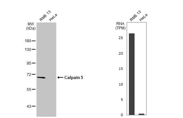 <b>Orthogonal Strategies Validation. </b>Western Blot: Calpain 5 Antibody (HL2432) - Azide and BSA Free [NBP3-25394] - Various whole cell extracts (30 ug) were separated by 7.5% SDS-PAGE, and the membrane was blotted with Calpain 5 antibody [HL2432] (NBP3-25394) diluted at 1:1000. The HRP-conjugated anti-rabbit IgG antibody was used to detect the primary antibody. Corresponding RNA expression data for the same cell lines are based on Human Protein Atlas program.