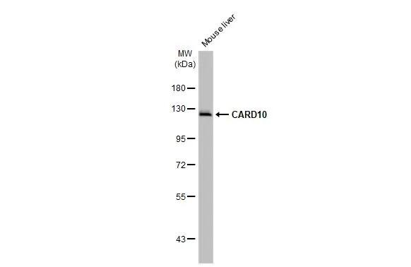 Western Blot: CARD10 Antibody (HL2261) - Azide and BSA Free [NBP3-25396] - Mouse tissue extract (50 ug) was separated by 7.5% SDS-PAGE, and the membrane was blotted with CARD10 antibody [HL2261] (NBP3-25396) diluted at 1:500. The HRP-conjugated anti-rabbit IgG antibody was used to detect the primary antibody, and the signal was developed with Trident ECL plus-Enhanced.