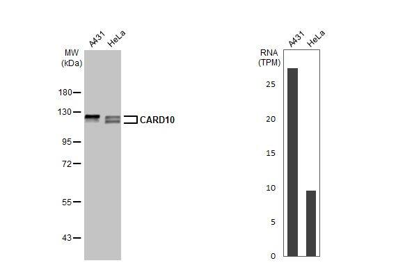 <b>Orthogonal Strategies Validation. </b>Western Blot: CARD10 Antibody (HL2261) - Azide and BSA Free [NBP3-25396] - Various whole cell extracts (30 ug) were separated by 7.5% SDS-PAGE, and the membrane was blotted with CARD10 antibody [HL2261] (NBP3-25396) diluted at 1:1000. The HRP-conjugated anti-rabbit IgG antibody was used to detect the primary antibody, and the signal was developed with Trident ECL plus-Enhanced. Corresponding RNA expression data for the same cell lines are based on Human Protein Atlas program.