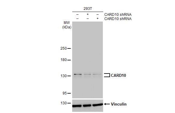 <b>Genetic Strategies Validation. </b>Knockdown Validated: CARD10 Antibody (HL2261) - Azide and BSA Free [NBP3-25396] - Non-transfected (-) and transfected (+) 293T whole cell extracts (30 ug) were separated by 5% SDS-PAGE, and the membrane was blotted with CARD10 antibody [HL2261] (NBP3-25396) diluted at 1:1000. The HRP-conjugated anti-rabbit IgG antibody was used to detect the primary antibody, and the signal was developed with Trident ECL plus-Enhanced.