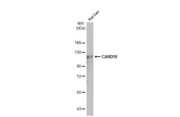 Western Blot: CARD10 Antibody (HL2261) - Azide and BSA Free [NBP3-25396] - Rat tissue extract (50 ug) was separated by 7.5% SDS-PAGE, and the membrane was blotted with CARD10 antibody [HL2261] (NBP3-25396) diluted at 1:500. The HRP-conjugated anti-rabbit IgG antibody was used to detect the primary antibody, and the signal was developed with Trident ECL plus-Enhanced.