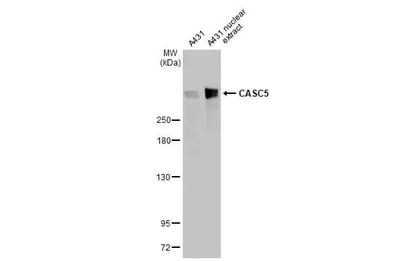 Western Blot: CASC5 Antibody (HL2158) - Azide and BSA Free [NBP3-25397] - A431 whole cell and nuclear extracts (30 ug) were separated by 5% SDS-PAGE, and the membrane was blotted with CASC5 antibody [HL2158] (NBP3-25397) diluted at 1:1000. The HRP-conjugated anti-rabbit IgG antibody was used to detect the primary antibody, and the signal was developed with Trident ECL plus-Enhanced.