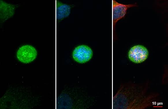 Immunocytochemistry/Immunofluorescence: CASC5 Antibody (HL2158) - Azide and BSA Free [NBP3-25397] - CASC5 antibody [HL2158] detects CASC5 protein at kinetochore by immunofluorescent analysis. Sample: HeLa cells were fixed in 4% paraformaldehyde at RT for 15 min. Green: CASC5 stained by CASC5 antibody [HL2158] (NBP3-25397) diluted at 1:500. Red: alpha Tubulin, a cytoskeleton marker, stained by alpha Tubulin antibody [GT114] (NBP2-43837) diluted at 1:1000. Blue: Fluoroshield with DAPI .