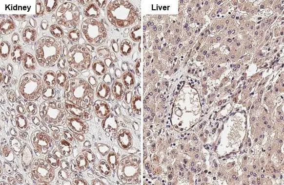 Immunohistochemistry-Paraffin: Cathepsin S Antibody (HL2302) - Azide and BSA Free [NBP3-25398] - Cathepsin S antibody [HL2302] detects Cathepsin S protein at cytoplasm by immunohistochemical analysis. Sample: Paraffin-embedded human tissue. Cathepsin S stained by Cathepsin S antibody [HL2302] (NBP3-25398) diluted at 1:100. Antigen Retrieval: Citrate buffer, pH 6.0, 15 min