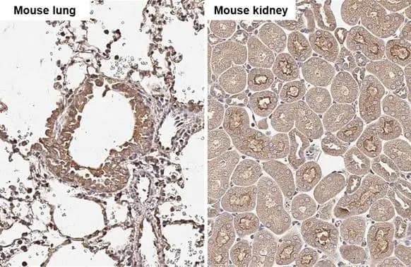 <b>Orthogonal Strategies Validation. </b>Immunohistochemistry-Paraffin: Cathepsin S Antibody (HL2302) - Azide and BSA Free [NBP3-25398] - Cathepsin S antibody [HL2302] detects Cathepsin S protein by immunohistochemical analysis. Sample: Paraffin-embedded mouse tissues. Cathepsin S stained by Cathepsin S antibody [HL2302] (NBP3-25398) diluted at 1:100. Antigen Retrieval: Citrate buffer, pH 6.0, 15 min