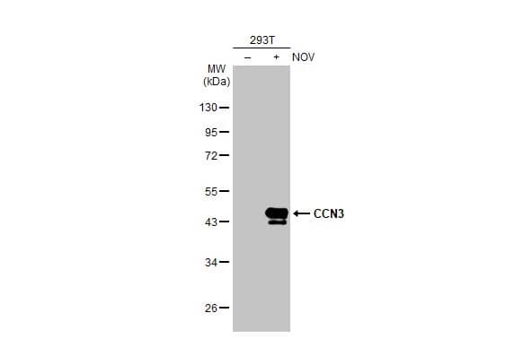 Western Blot: NOV/CCN3 Antibody (HL2416) - Azide and BSA Free [NBP3-25401] - Non-transfected (-) and transfected (+) 293T whole cell extracts (30 ug) were separated by 10% SDS-PAGE, and the membrane was blotted with CCN3 antibody [HL2416] (NBP3-25401) diluted at 1:5000. The HRP-conjugated anti-rabbit IgG antibody was used to detect the primary antibody.