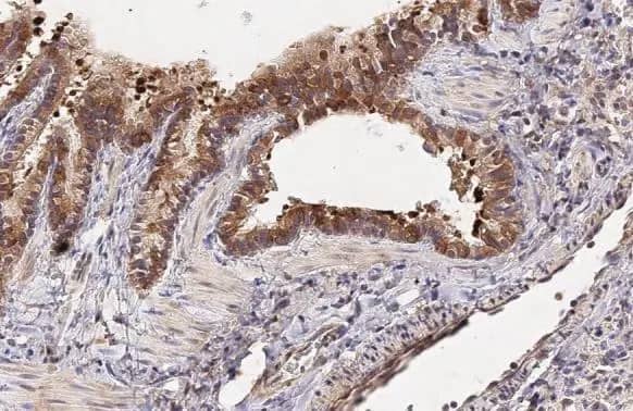 Immunohistochemistry-Paraffin: NOV/CCN3 Antibody (HL2416) - Azide and BSA Free [NBP3-25401] - CCN3 antibody [HL2416] detects secreted CCN3 protein by immunohistochemical analysis. Sample: Paraffin-embedded rat lung. CCN3 stained by CCN3 antibody [HL2416] (NBP3-25401) diluted at 1:100. Antigen Retrieval: Citrate buffer, pH 6.0, 15 min