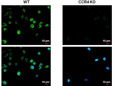 ICC/IF: CCR4 Antibody (HL2481) -SW480 cells were fixed in ice-cold MeOH for 5 min.Green: CCR4 stained by CCR4 antibody [HL2481] diluted at 1:200.Blue: Fluoroshield with DAPI. 