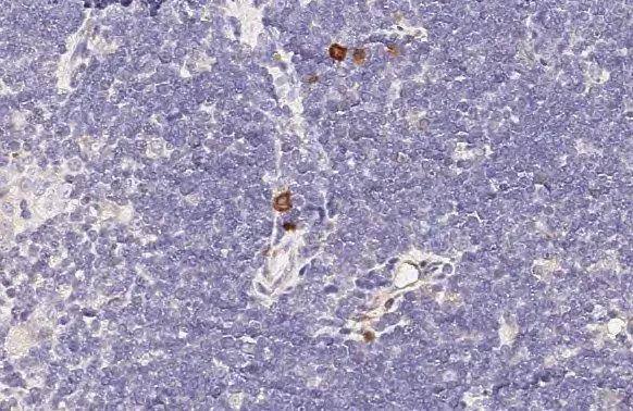 CCR4 antibody [HL2481] detects CCR4 protein by immunohistochemical analysis.Sample: Paraffin-embedded mouse thymus gland.CCR4 stained by CCR4 antibody [HL2481] (NBP3-25402) diluted at 1:500.Antigen Retrieval: Citrate buffer, pH 6.0, 15 min 