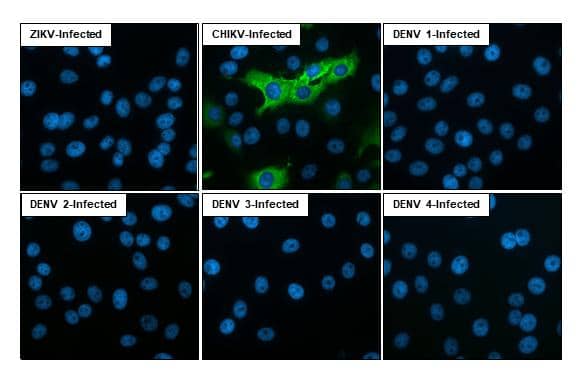 Chikungunya virus E1 antibody [HL2069] detects Chikungunya virus E1 protein by immunofluorescent analysis.Sample: Mock and multiple virus infected cells slide.Green: Chikungunya virus E1 stained by Chikungunya virus E1 antibody [HL2069] (NBP3-25406) diluted at 1:100.Blue: Fluoroshield with DAPI . 
